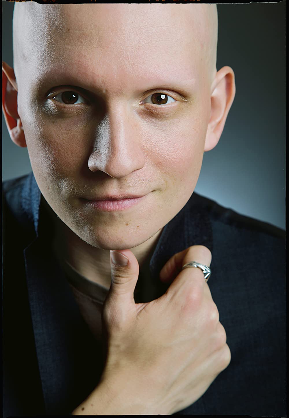 Anthony Carrigan